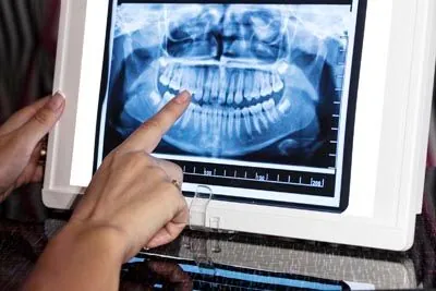 dentist review a patient's dental x-rays at Scott Condie Dentistry