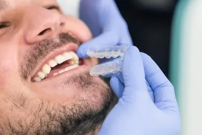 orthodontist placing a patient's new Invisalign aligners