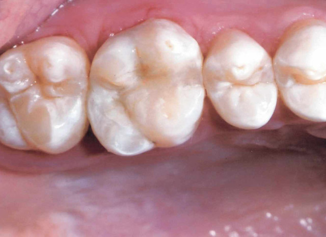 After image