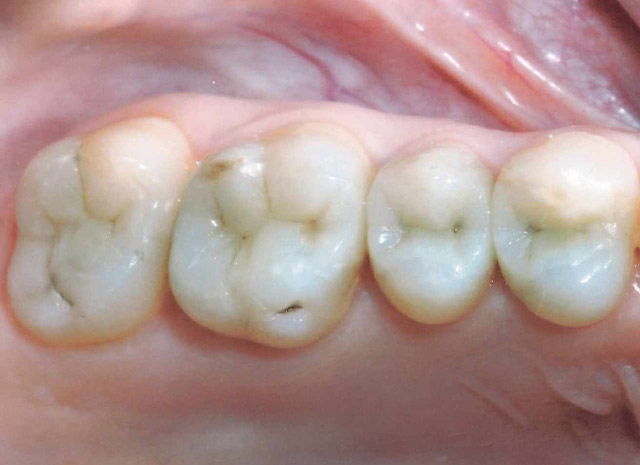 After image