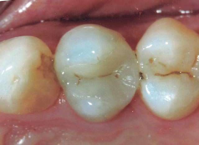 After image