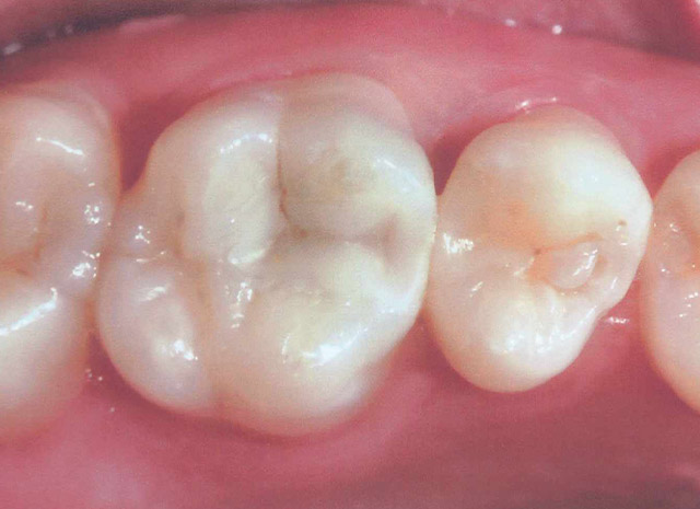 After image