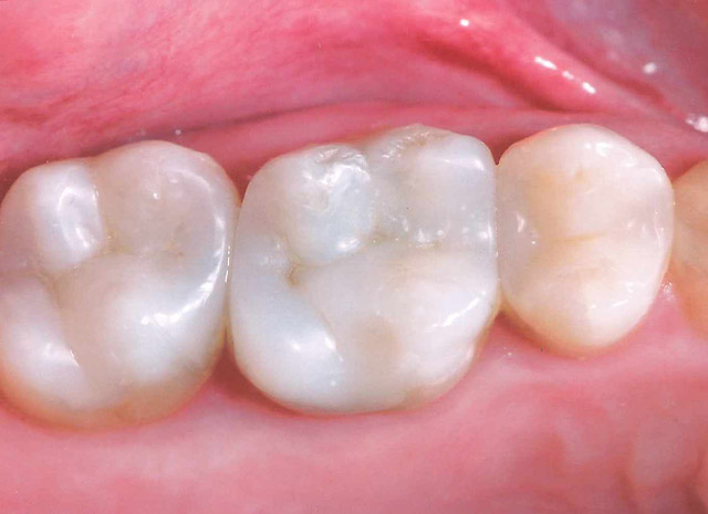 After image