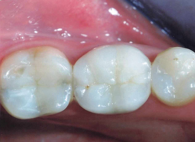After image