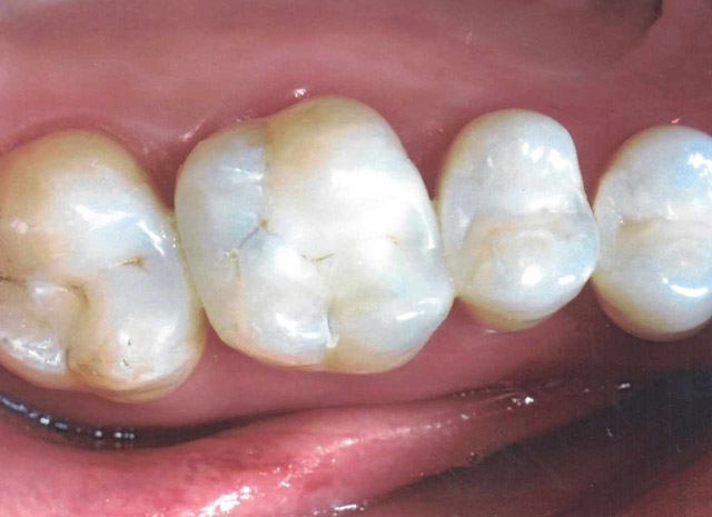 After image