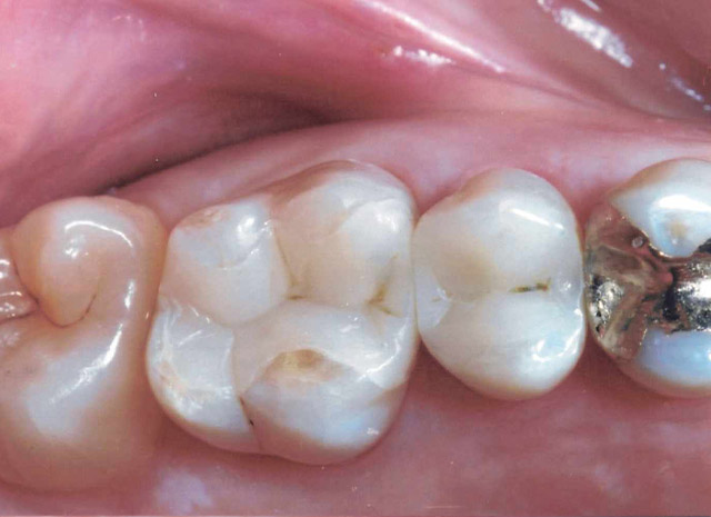 After image