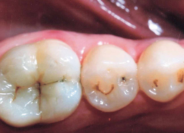 After image