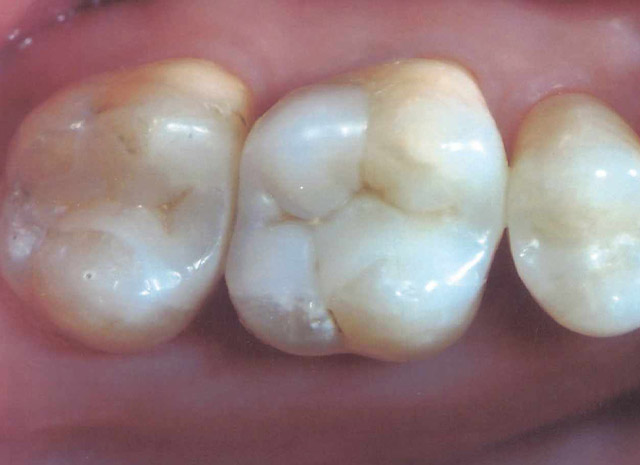 After image