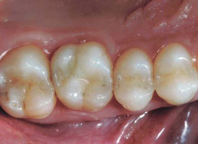 After image
