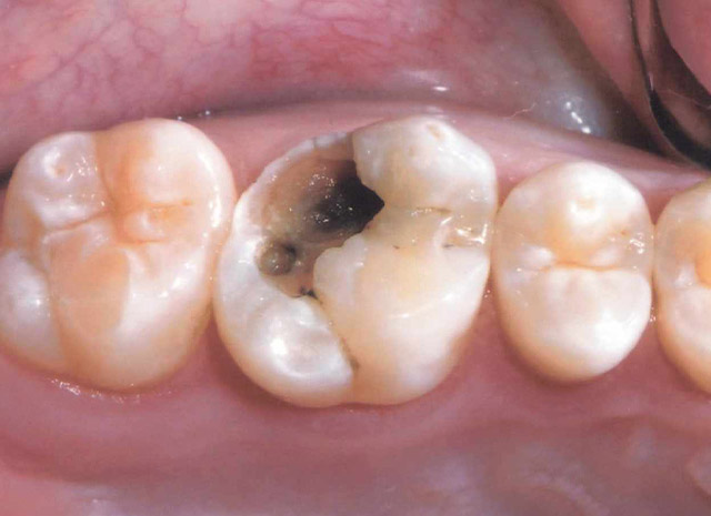 Before image