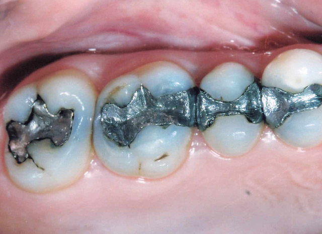 Before image