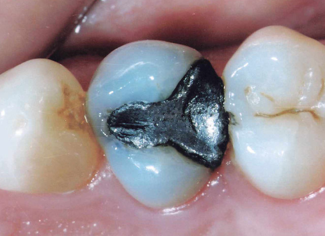 Before image