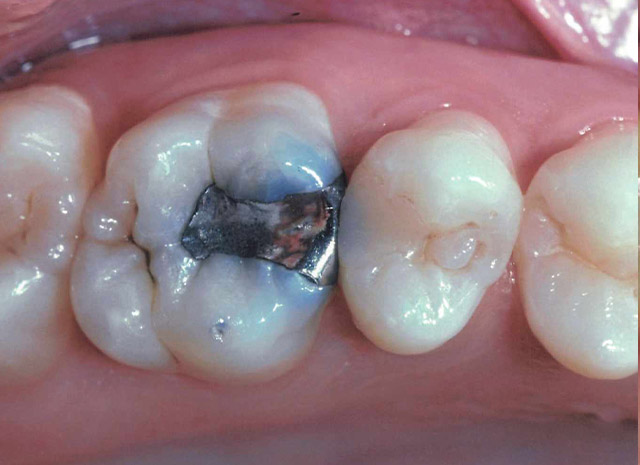 Before image