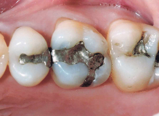 Before image