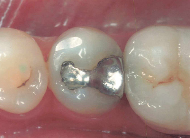 Before image