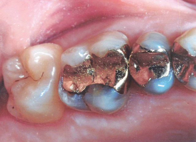 Before image