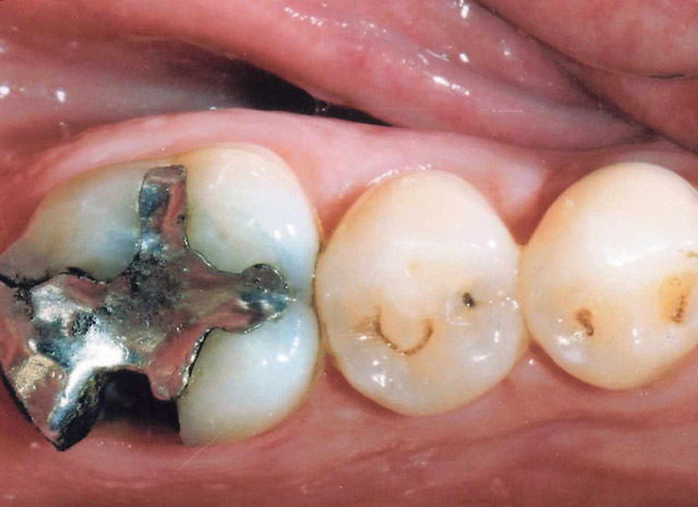 Before image