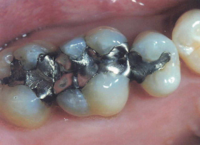 Before image