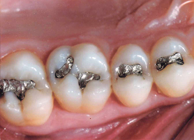 Before image